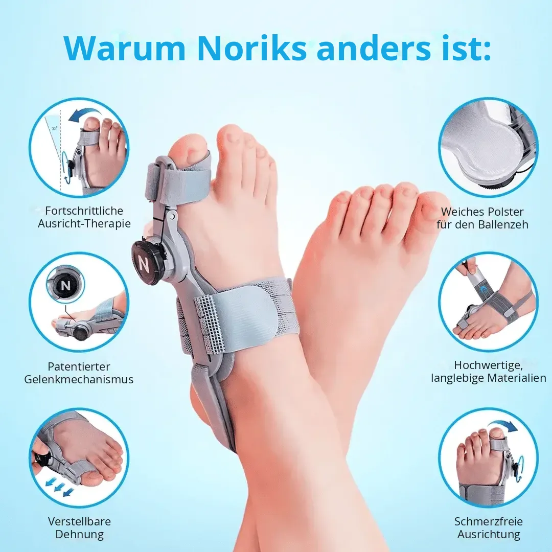 Warum der NORIKS Hallux-valgus-Korrektor anders ist