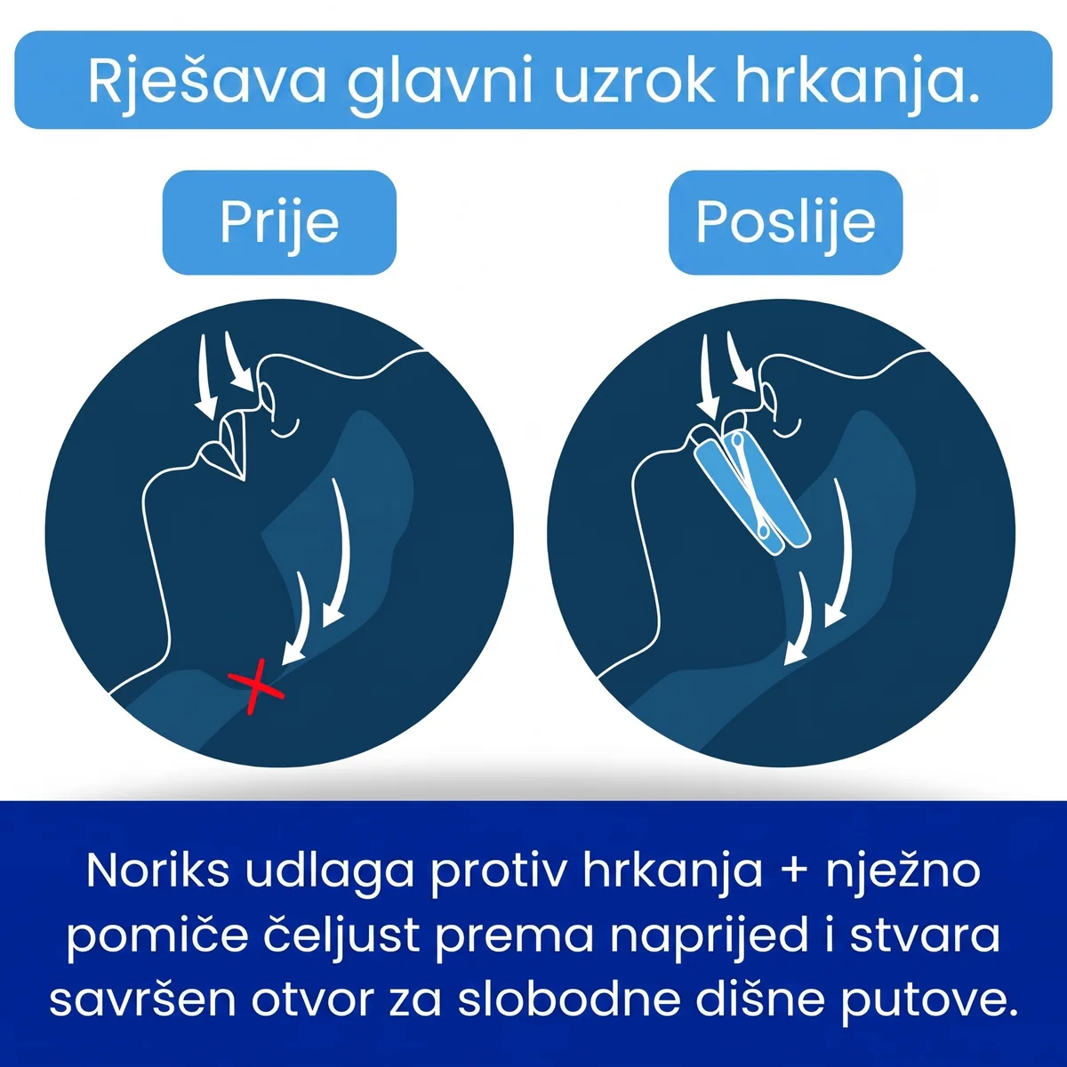 Prije i poslije — otvoren dišni put