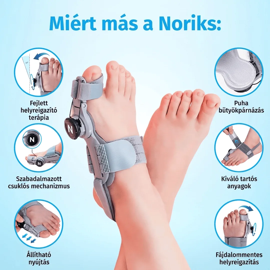 Miért más a NORIKS bütyökkorrigáló